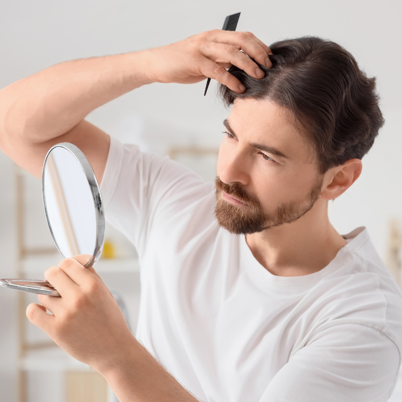 jovem calvos olhando seus sinais de calvície no espelho
