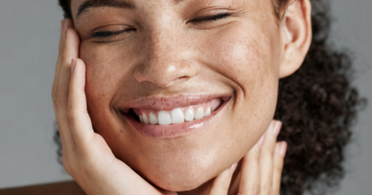 melasma na pele